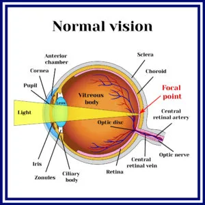 Normal Visual System | What Are Refractive Errors | Whitten Laser Eye